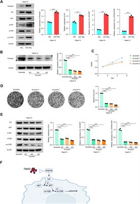 Integrated Analysis Reveals the Gut Microbial Metabolite TMAO Promotes Inflammatory Hepatocellular Carcinoma by Upregulating POSTN